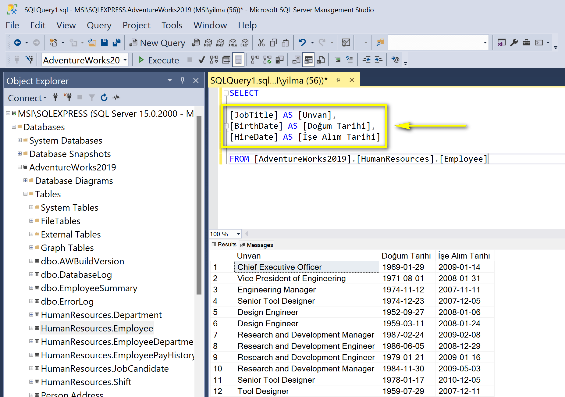 SQL sorgu ipuçları