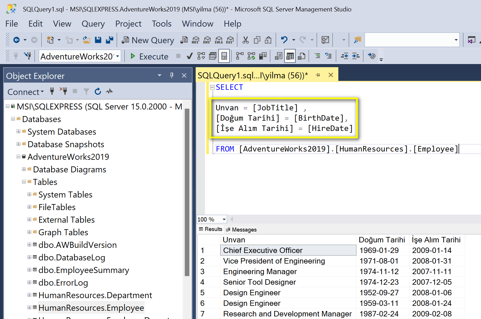 SQL sorgu ipuçları