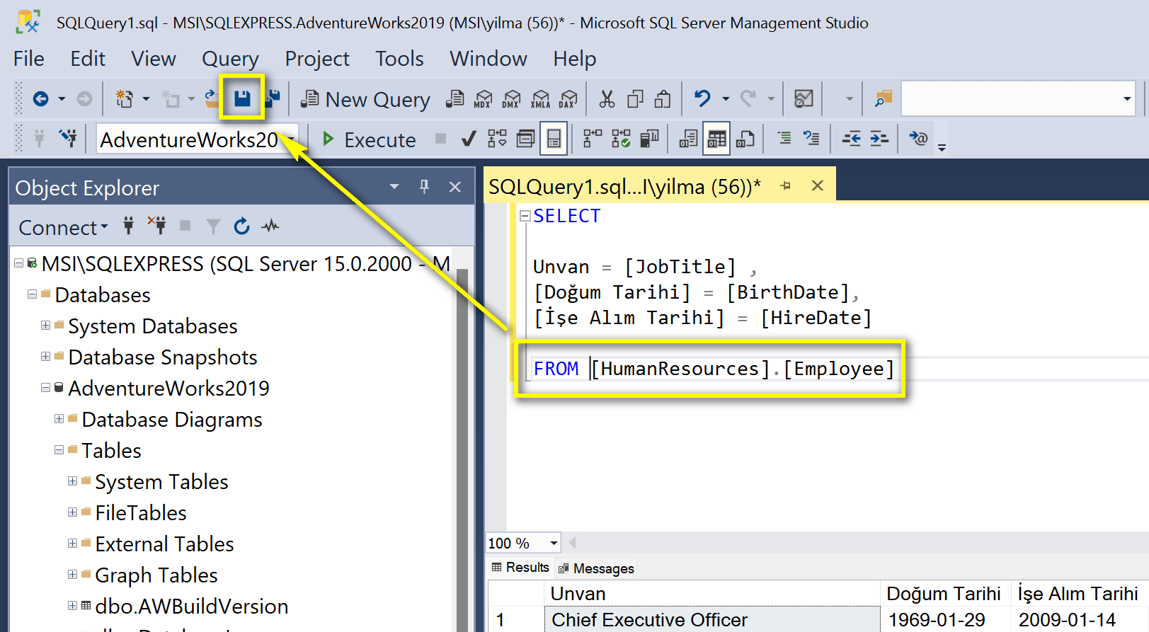 SQL sorgu ipuçları